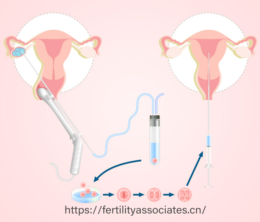 为何选择三代试管?技术优势深度剖析