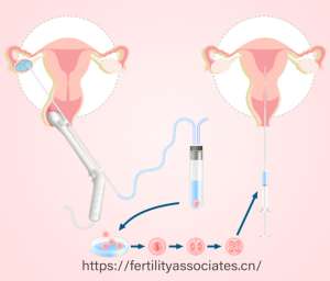 美国试管婴儿费用揭秘：2025年新