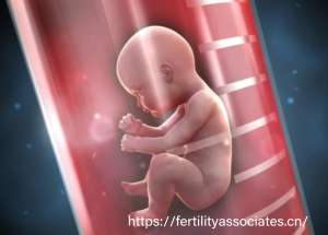 2026赴美试管婴儿预算指南:从3.5万